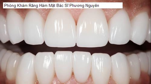 Hình ảnh Phòng Khám Răng Hàm Mặt Bác Sĩ Phương Nguyên