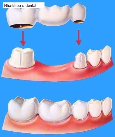 Hình ảnh Nha khoa s dental